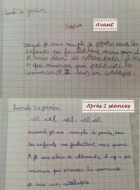 Exemple avant et après rééducation